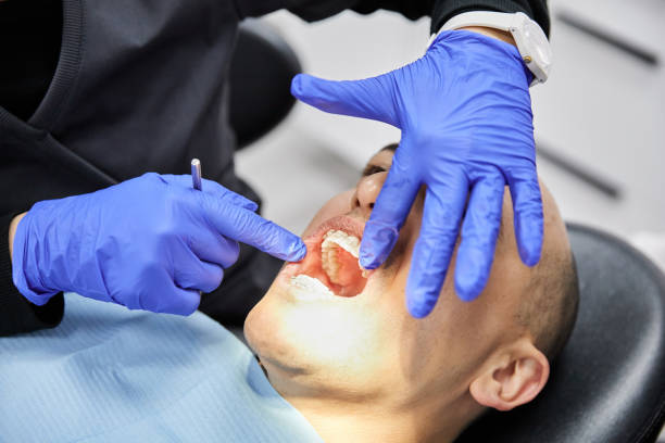 Best Emergency Tooth Extraction in North Laurel, MD