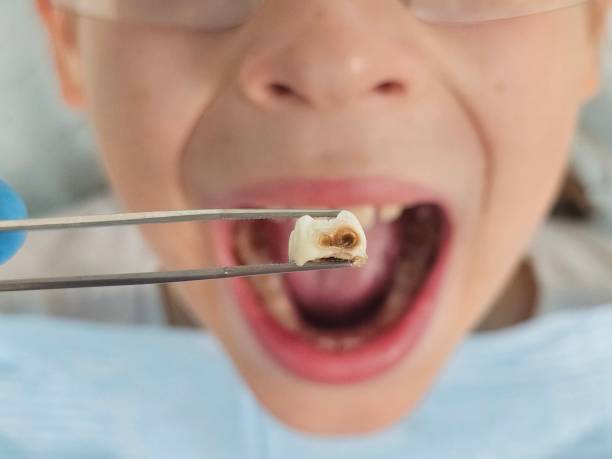 Best Weekend Emergency Dentist in North Laurel, MD