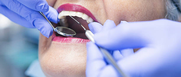 Best Emergency Dental Care for Broken or Chipped Teeth in North Laurel, MD